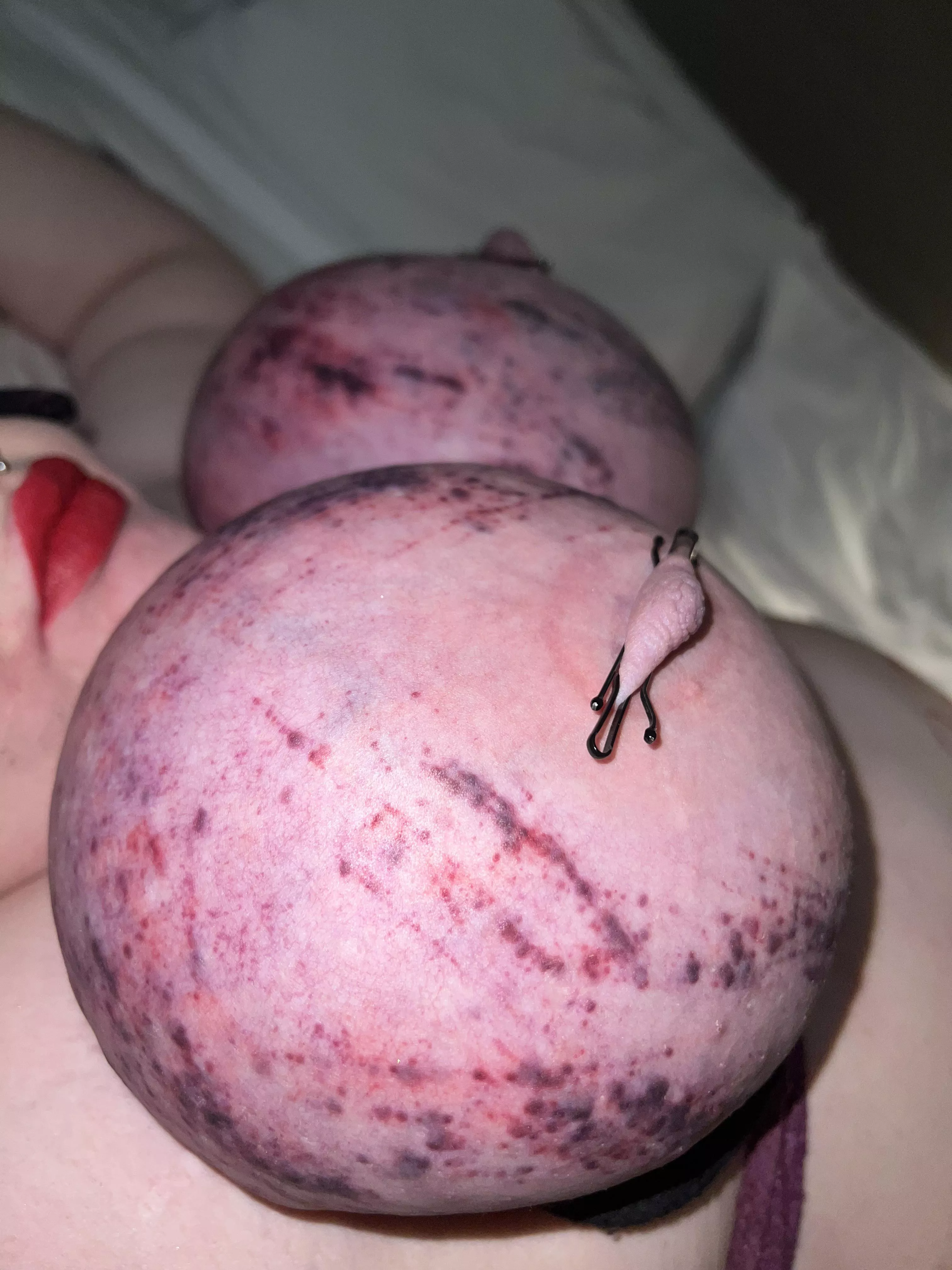 Tied my teen tits up then used nipple pumps before adding hair pins the whole time being beat with a homemade cane filled with a strangers cum from an hour earlier