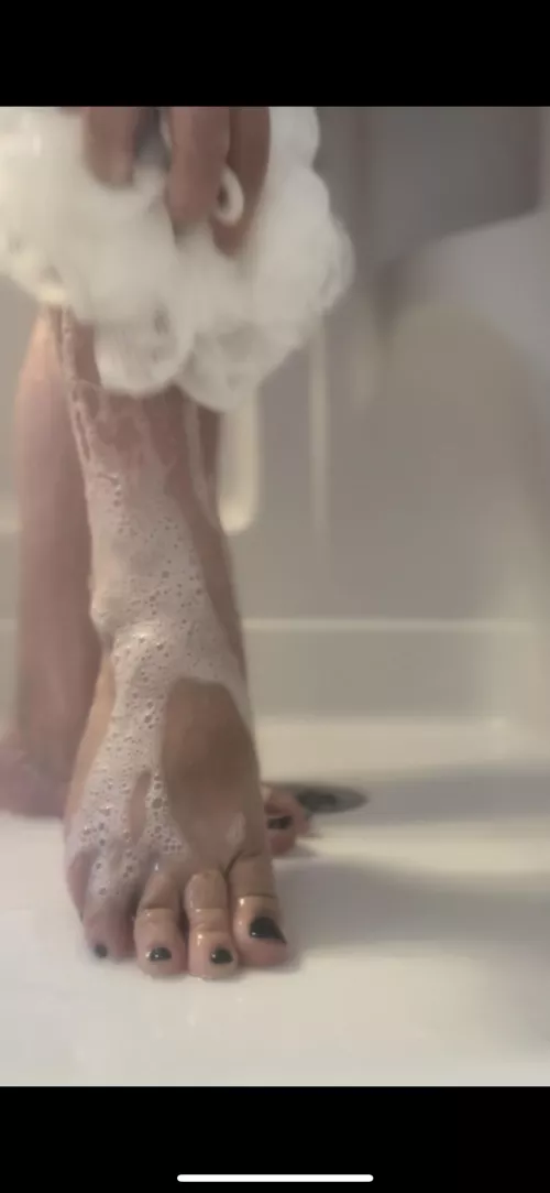 Can you see my freckle?