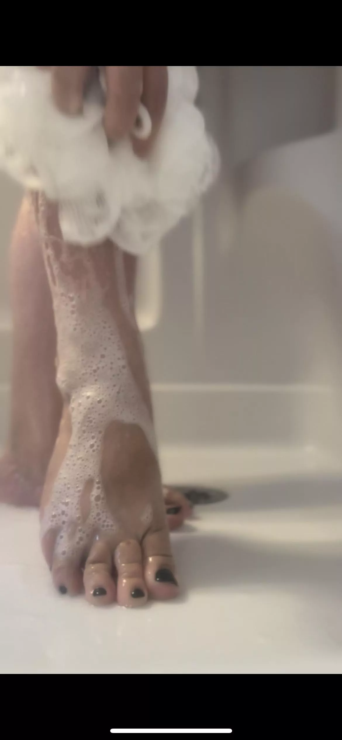 Can you see my freckle?