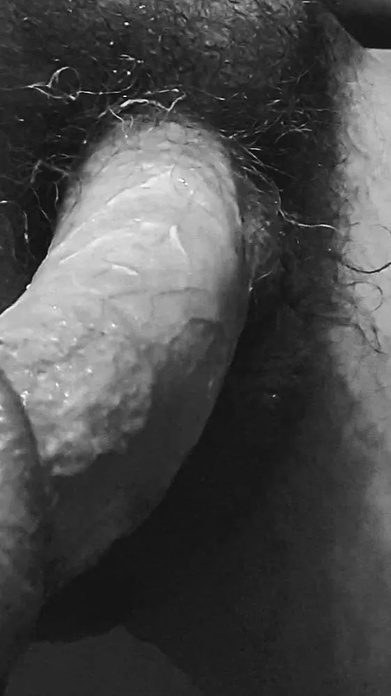 Even wilder in color😂😂😂