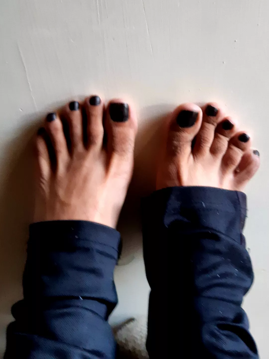 First time posting my feet.