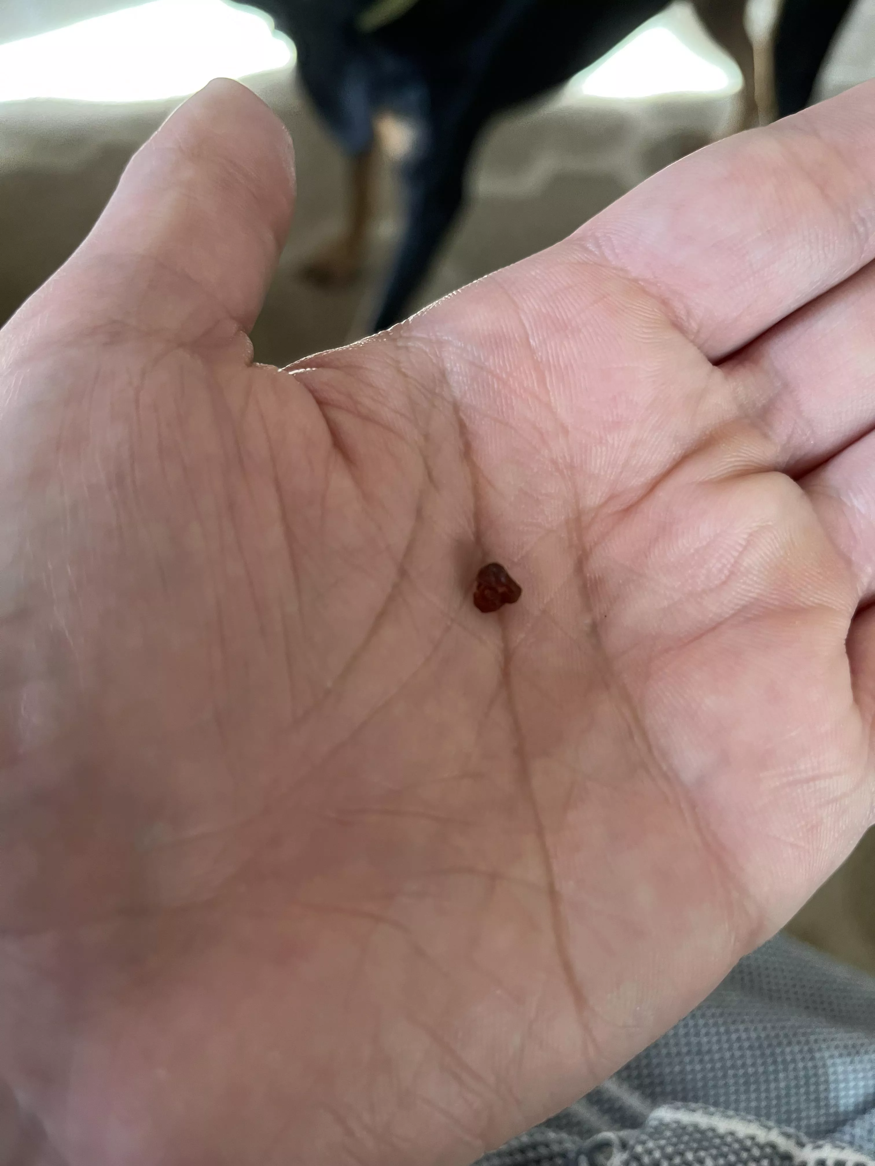 My ear birthed a lil wax baby