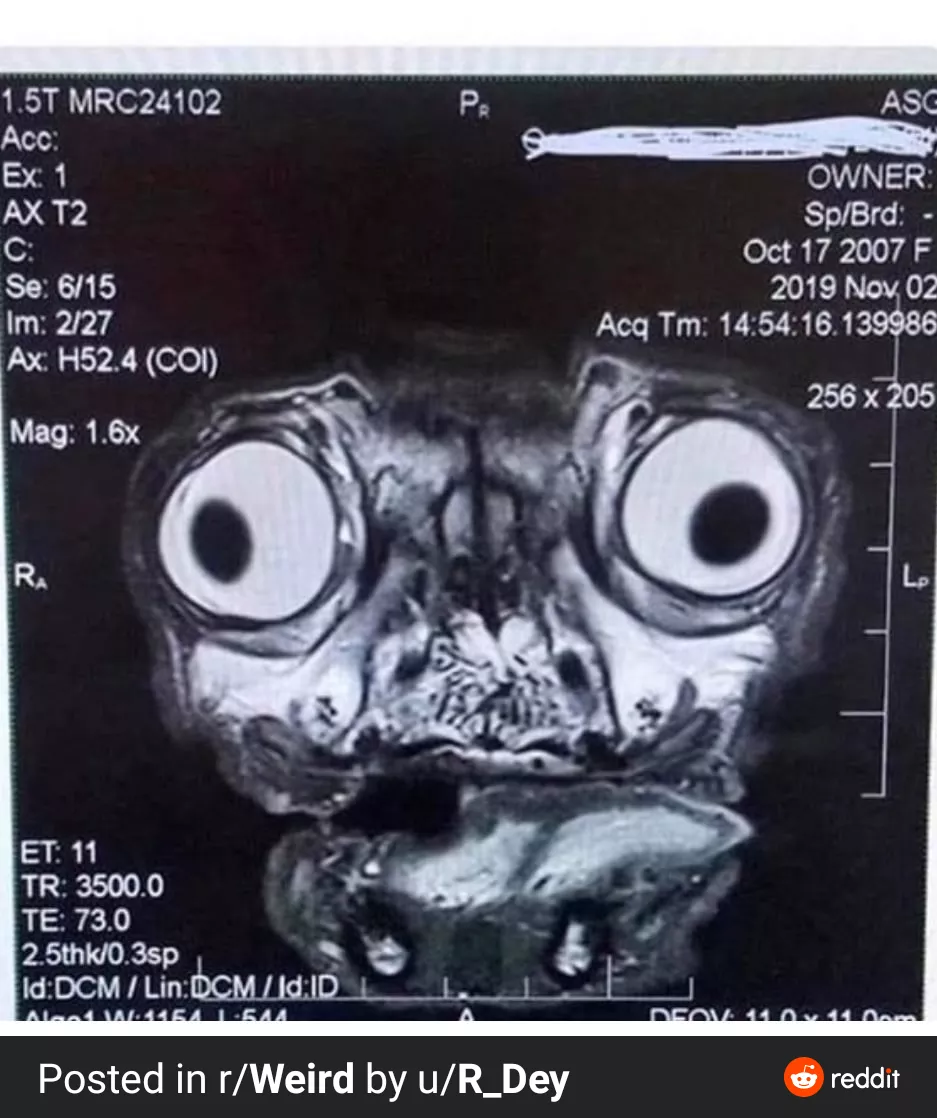 X-ray of cuttlefish of Cthulhu.