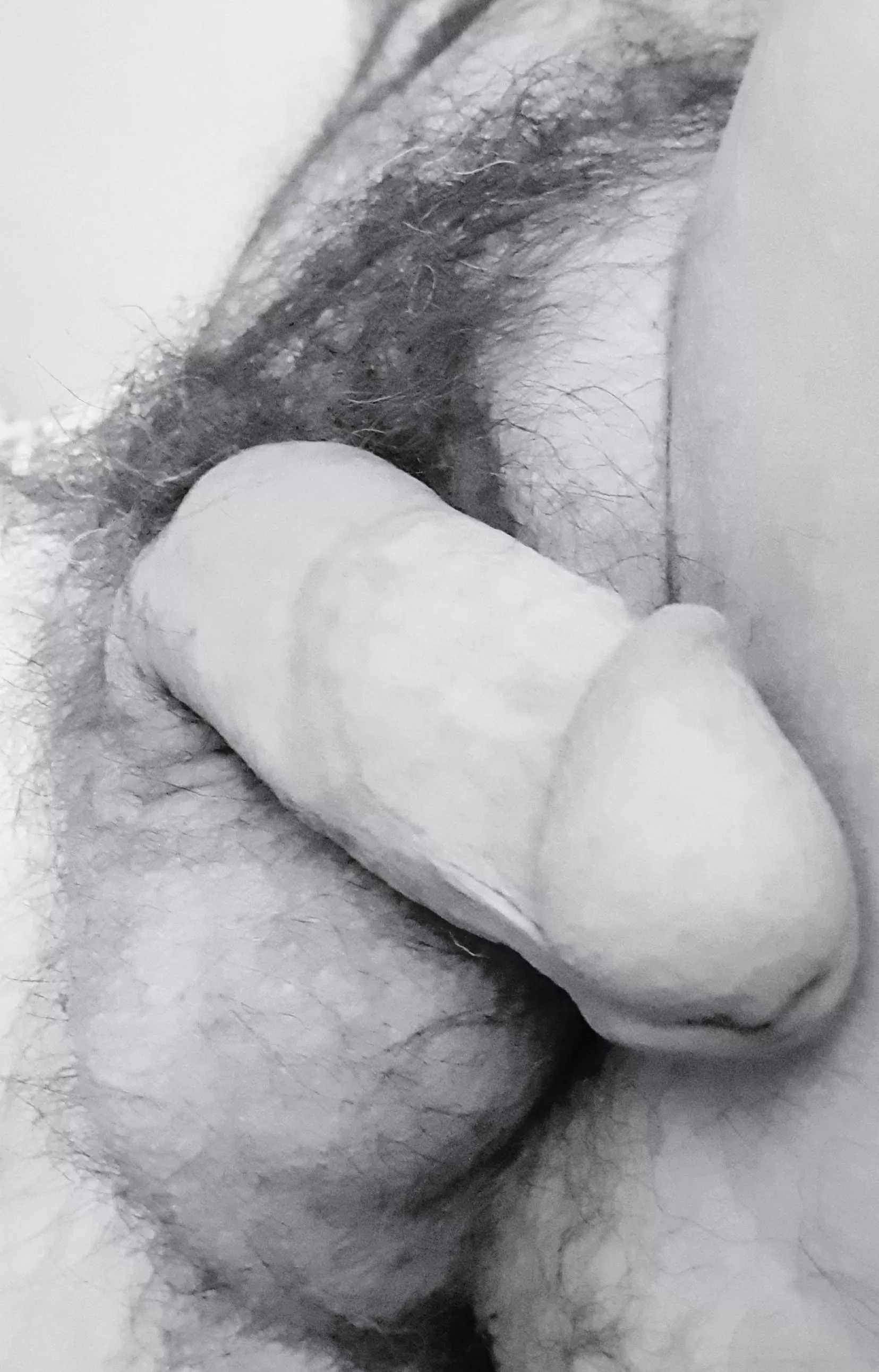 Do you like my scar?