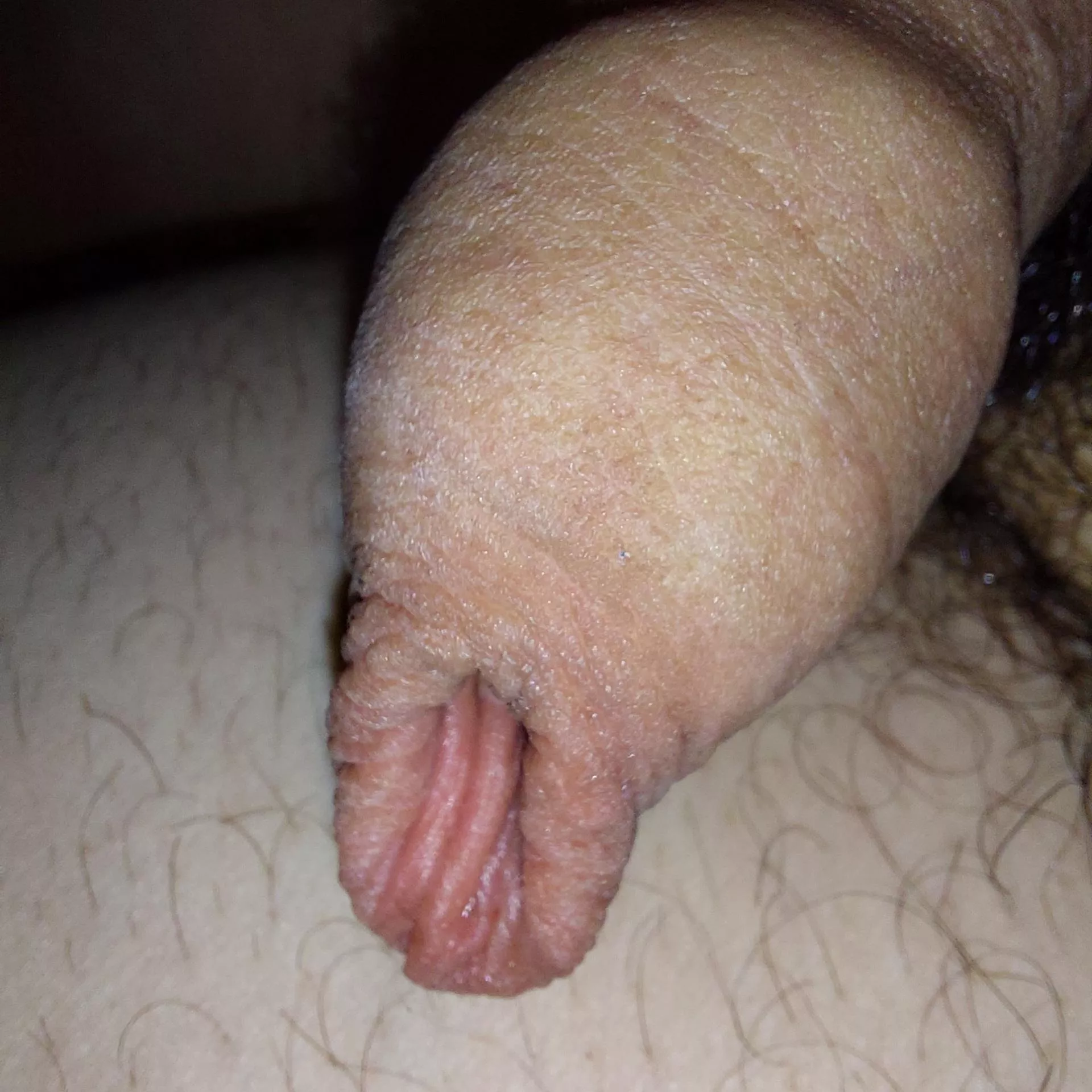 How do you like my foreskin?