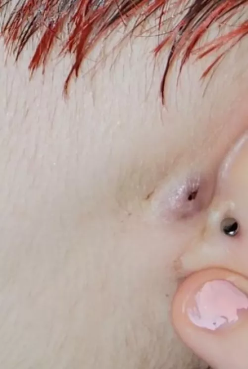 my mom refuses to take me to a doctor what should I do (explanation in comments)