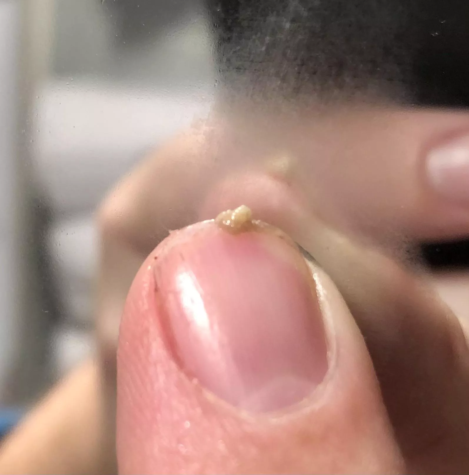 Quite a small harvest from squeezing all the blackheads on my nose. If I am disciplined and don’t touch it for a few weeks, the pile of gunk is even bigger after smearing all the blackhead gunk together.