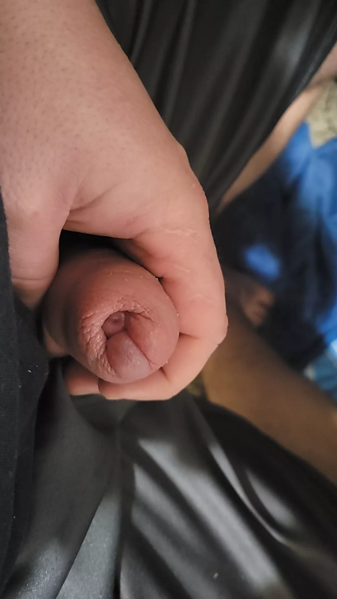 uncircumcised problems?? the top of my foreskin is tender