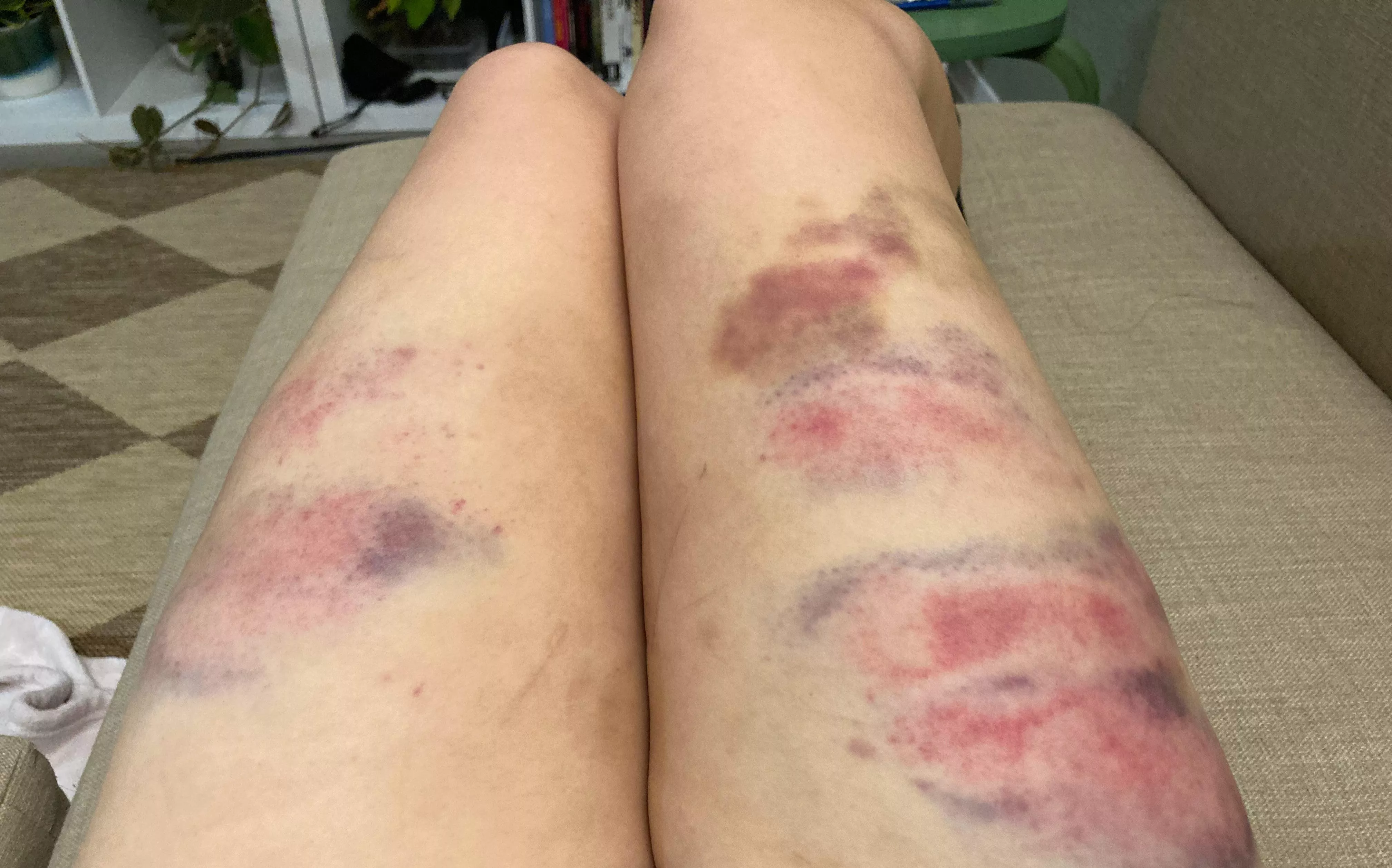 my girlfriend’s legs <3