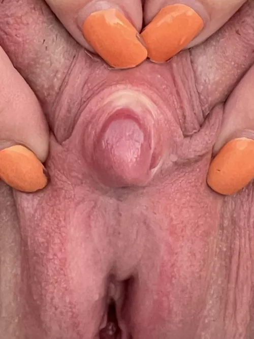 Please don’t look at my chipped nail polish.