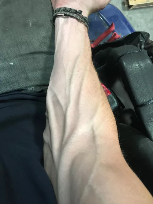 When work gets hectic, the veins get out of hand