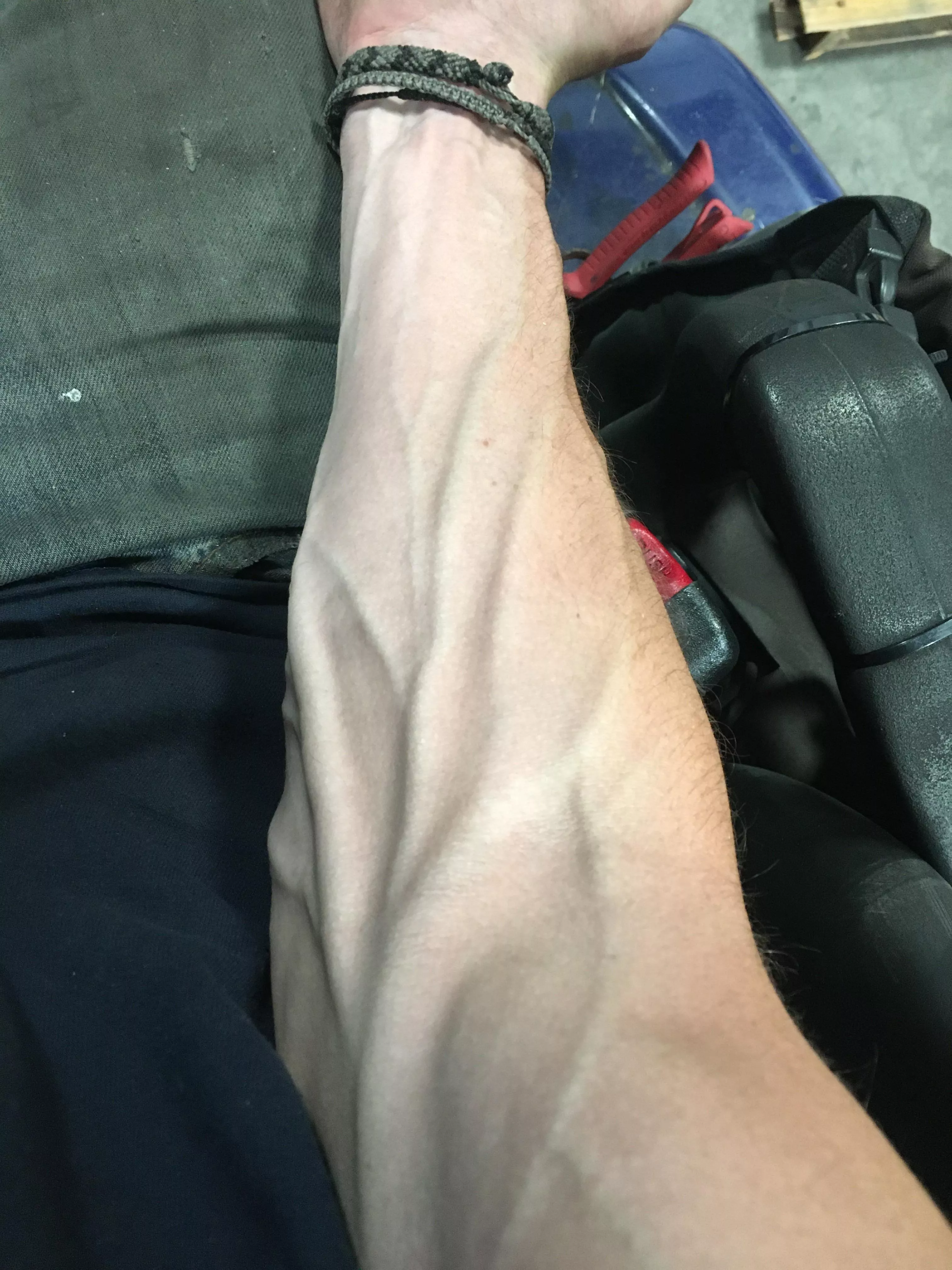 When work gets hectic, the veins get out of hand