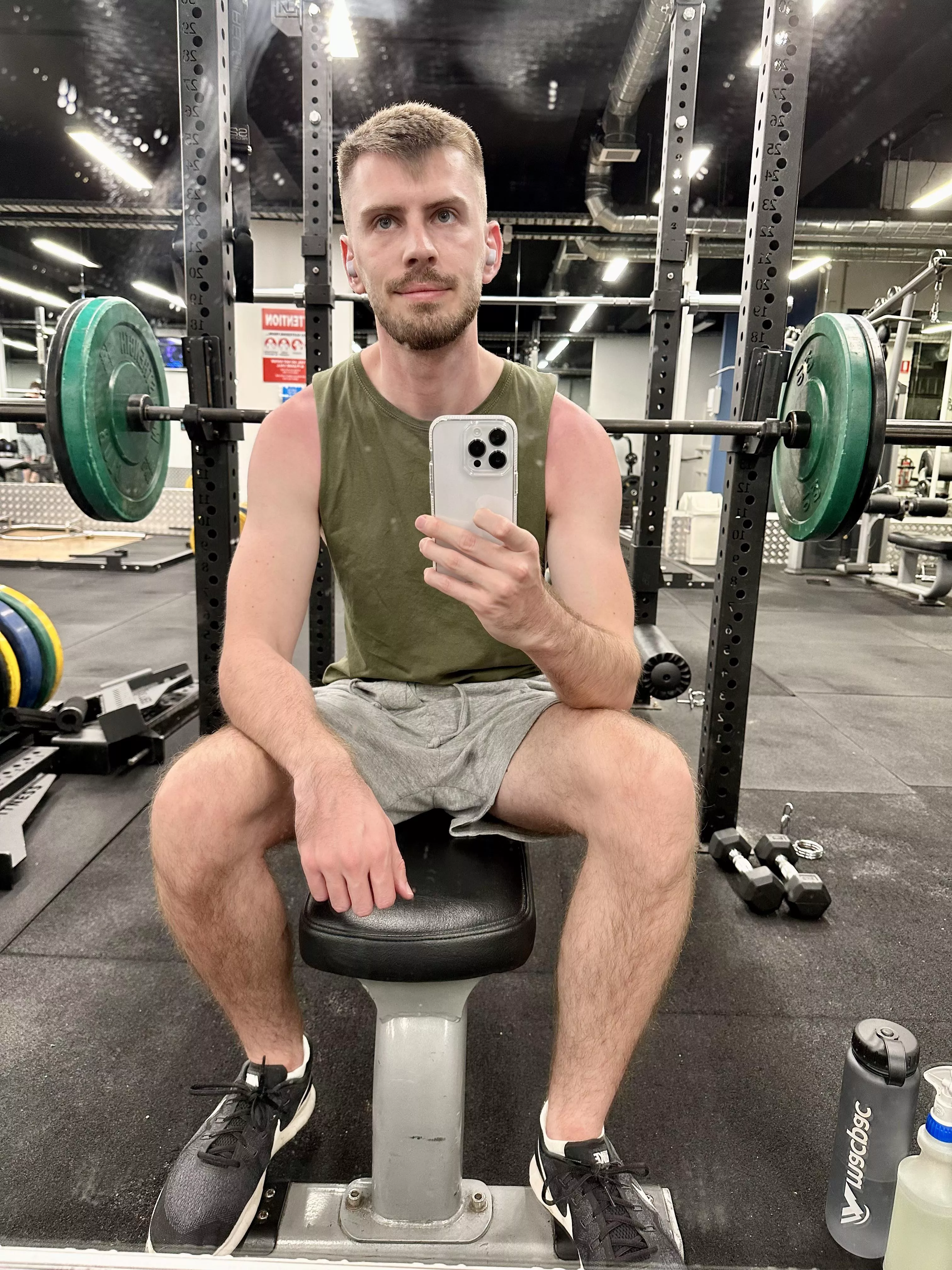 Burnt little Melbourne boy