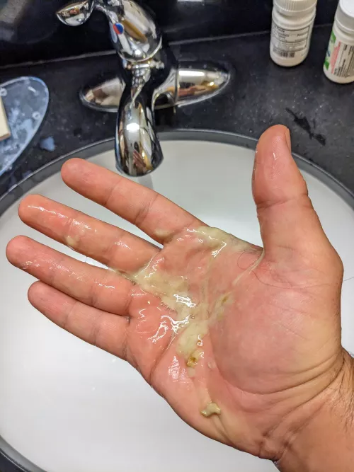 I have a nasty cold and I blew this out of my nose the other day