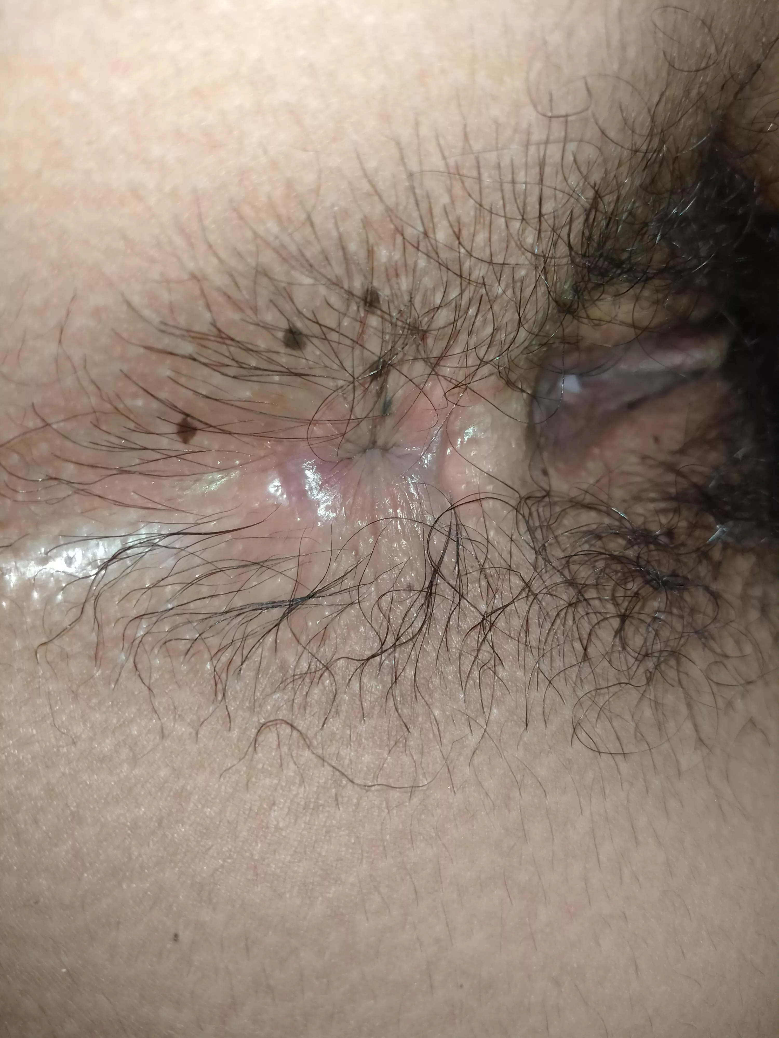 I hope this doesn't disgust you