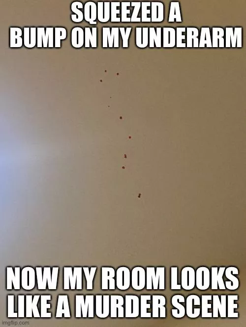 Anyone have a good way to clean blood off a ceiling?