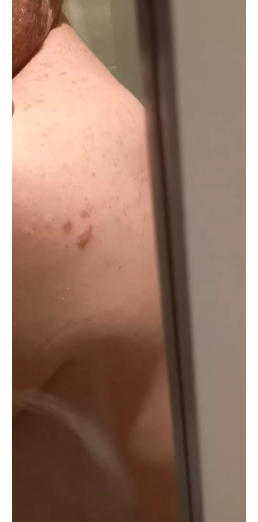 I know its not technically a pop but this is the only place that would appreciate my spotty smiley face!