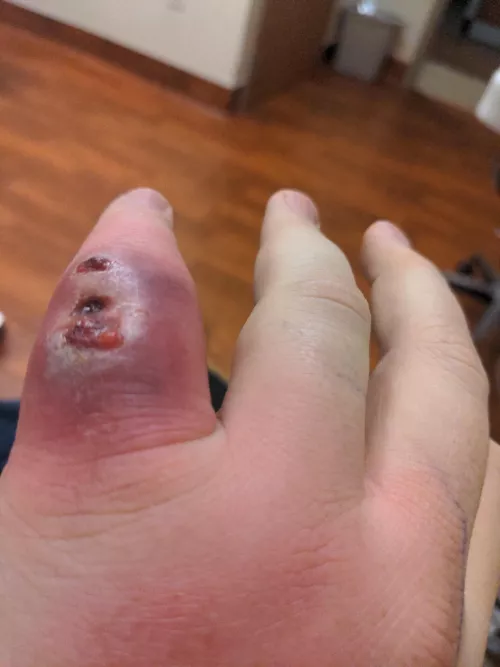 Bad news on my popping video