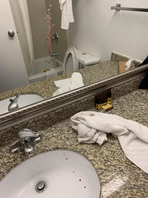 I don’t want to post a video of my ass online, even anonymously, but I figured you all would at least enjoy the aftermath of popping a pilonidal cyst. Also, my tailbone was just above the counter. It shot about a foot out AND up.