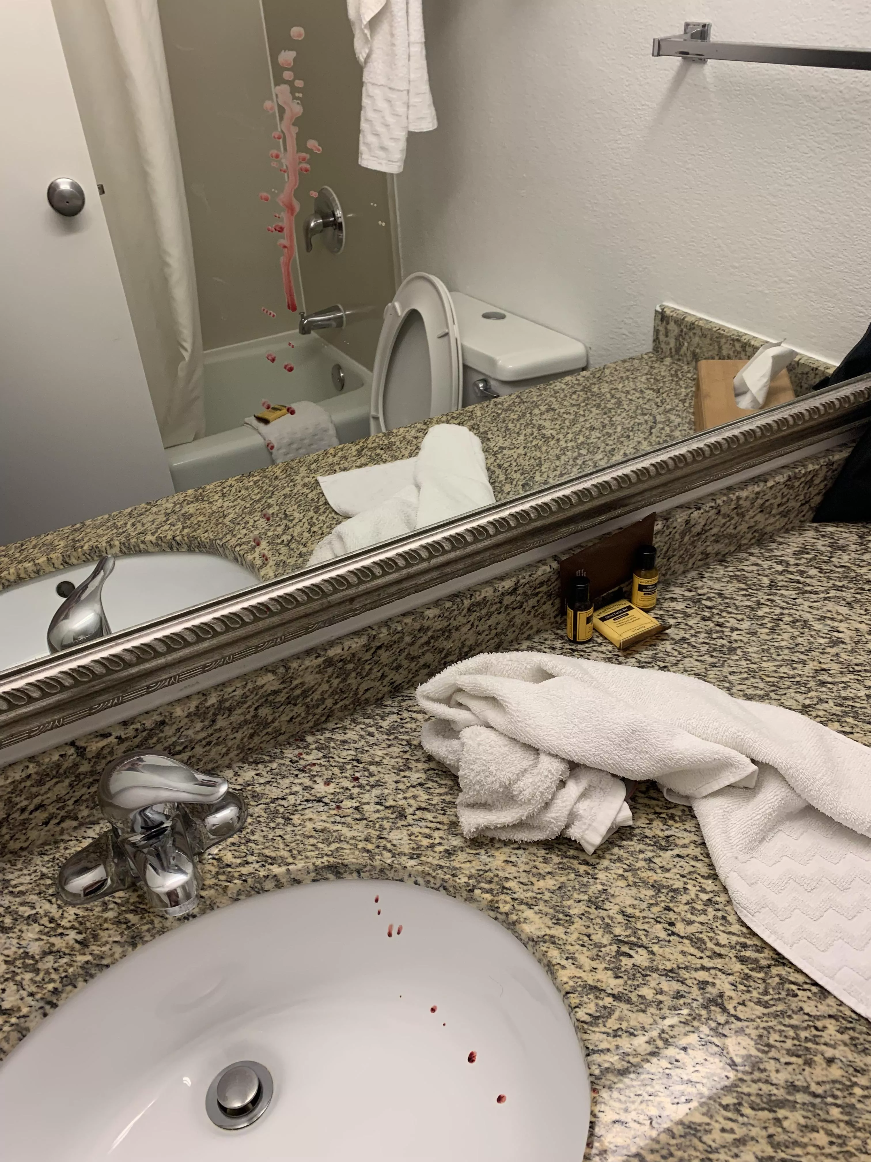 I don’t want to post a video of my ass online, even anonymously, but I figured you all would at least enjoy the aftermath of popping a pilonidal cyst. Also, my tailbone was just above the counter. It shot about a foot out AND up.