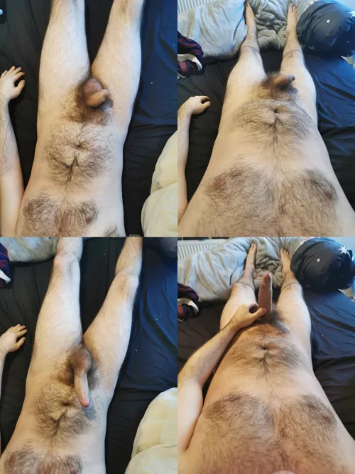 My hairy growing self!