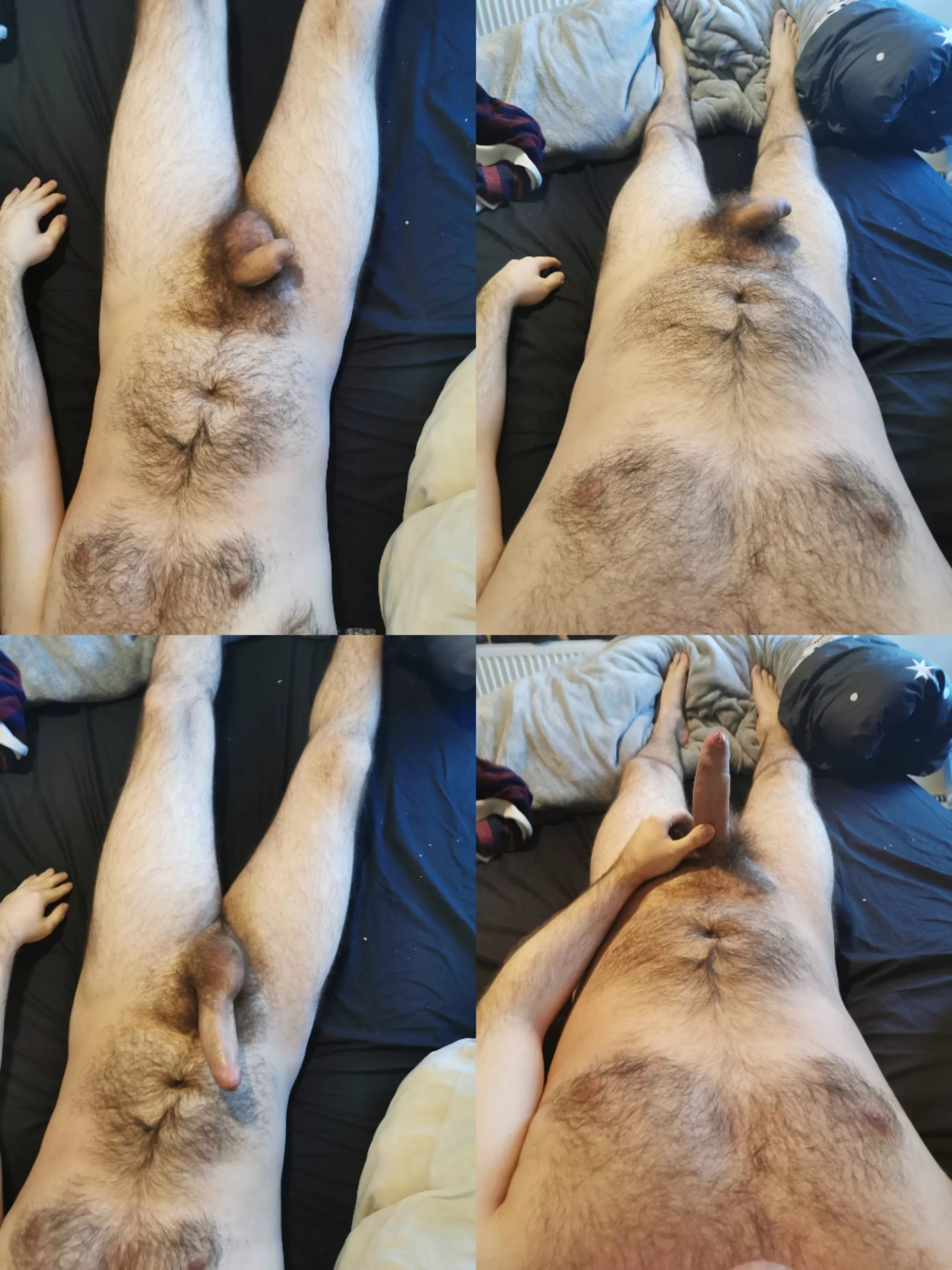 My hairy growing self!