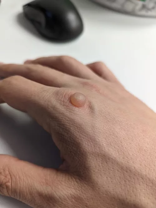 this one is ready to blow