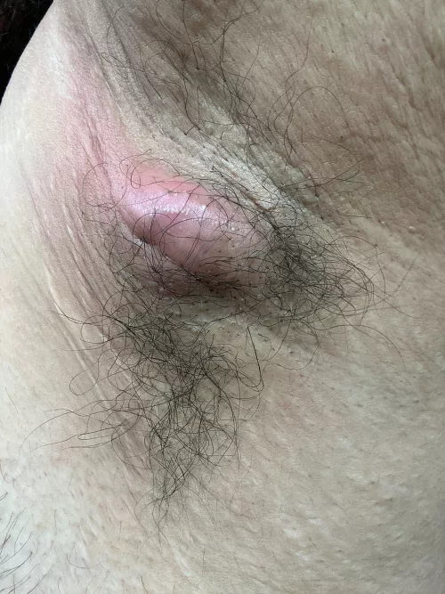 This Is Literally Killing Me