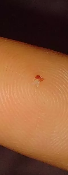 What are these under my scabs?