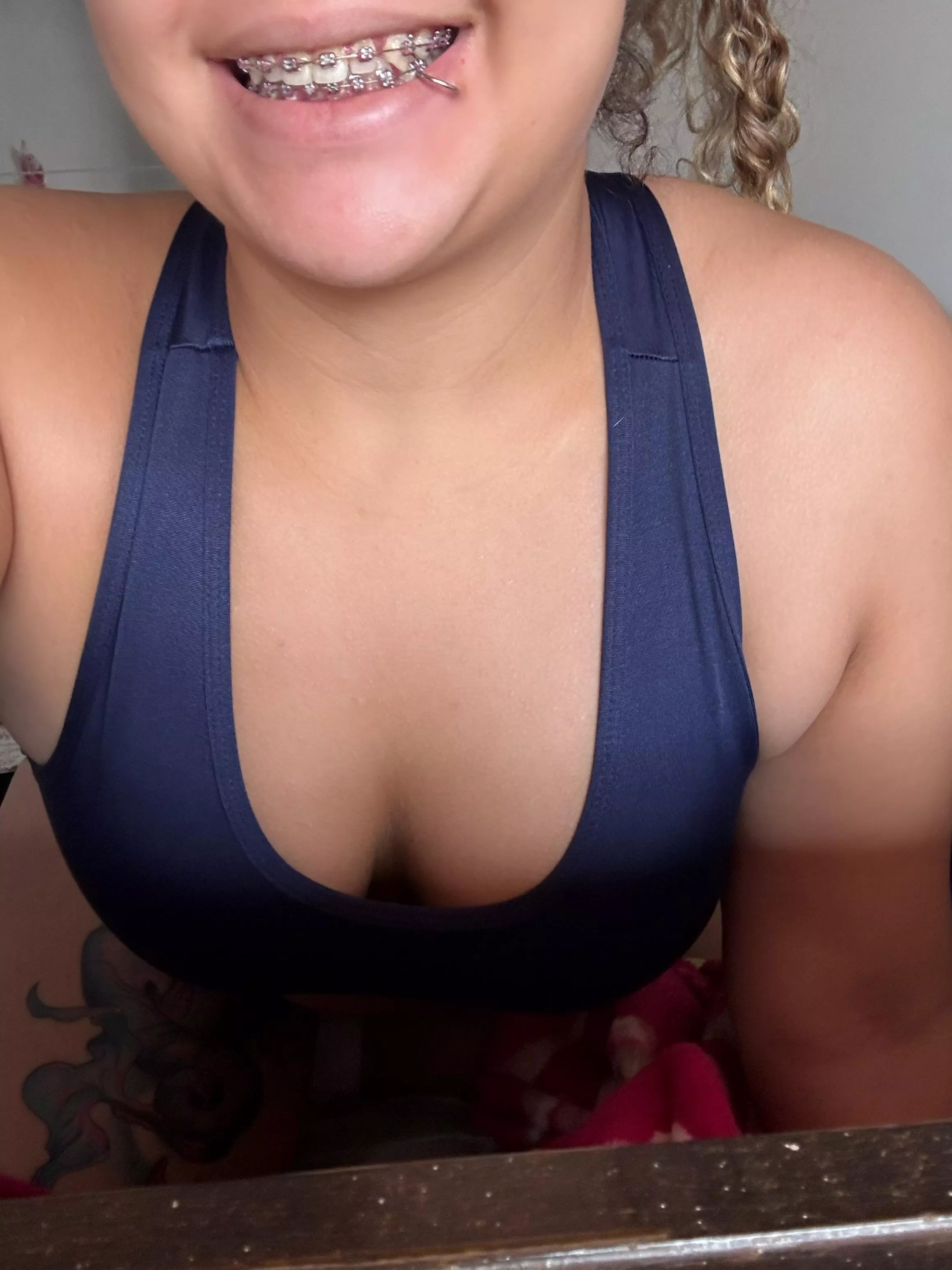 Do you like girls with braces?