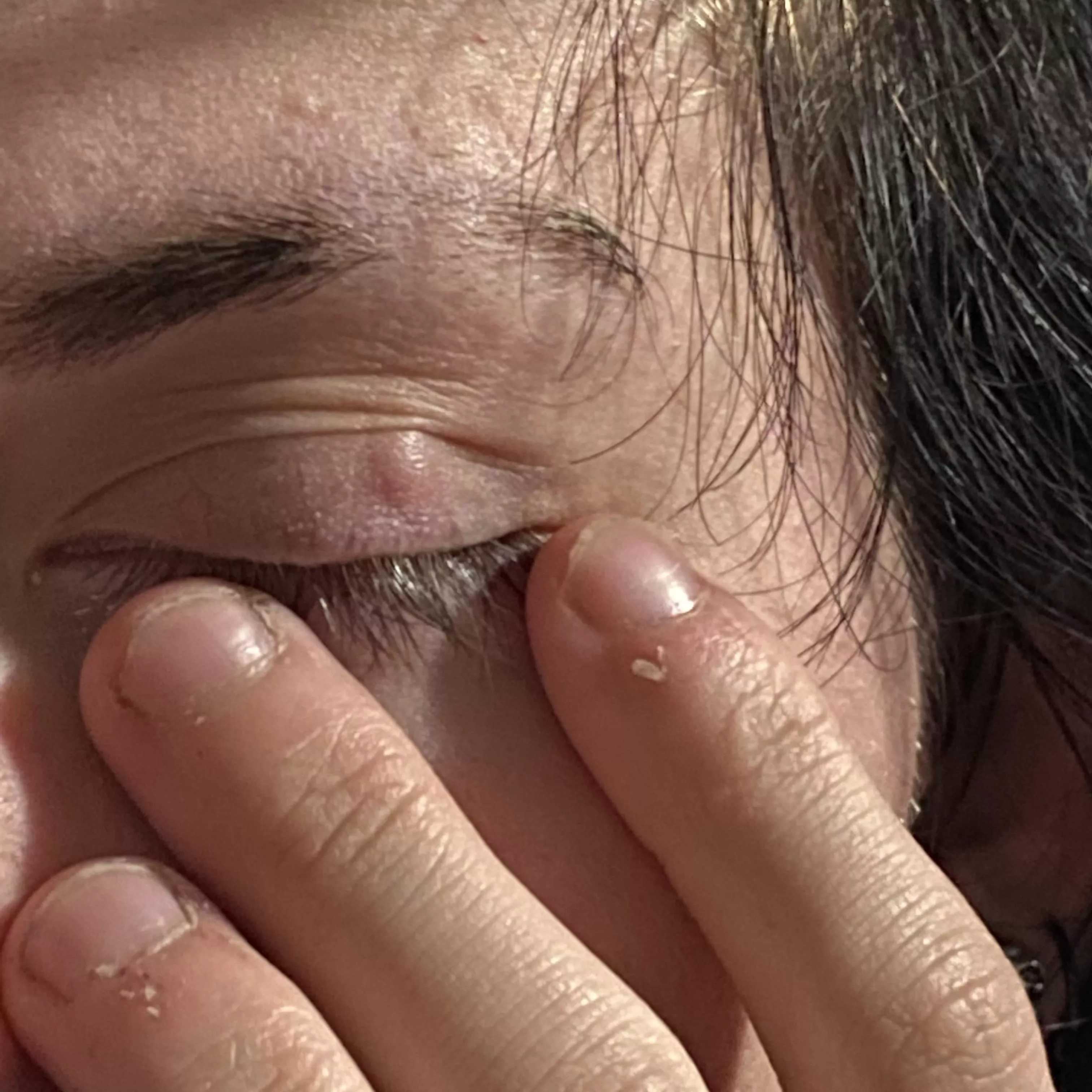 forbidden pop in my eyelid. it doesn’t feel like anything and i’ve had it a few months