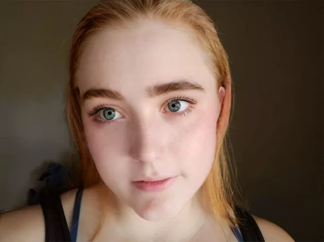 Freckles are fading in winter 😭