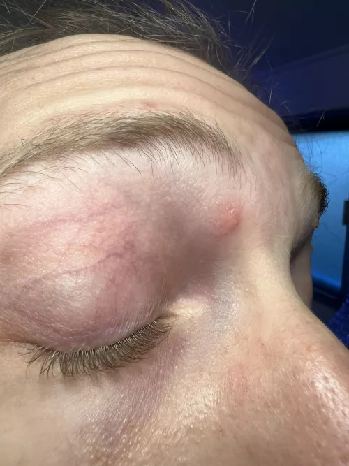 New Glasses and Holiday Szn Stress Left Me w/ This