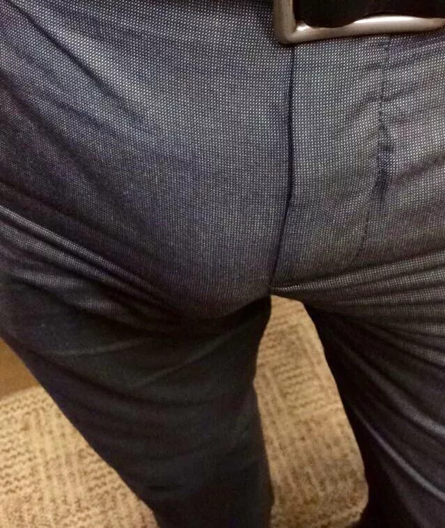 Maybe too tight dress pants?