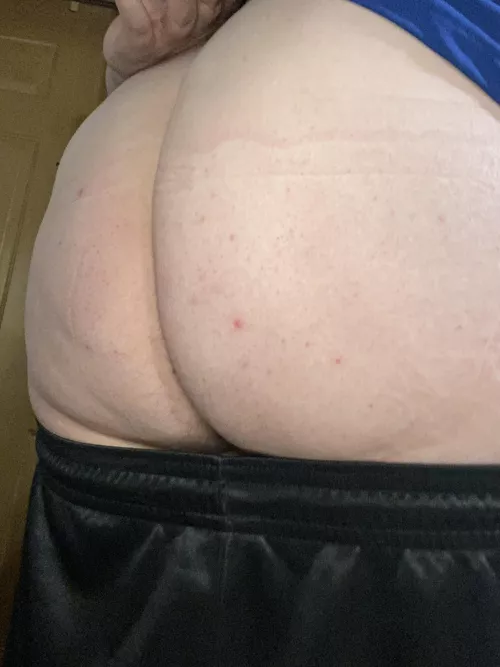 Wish I had someone to slap this