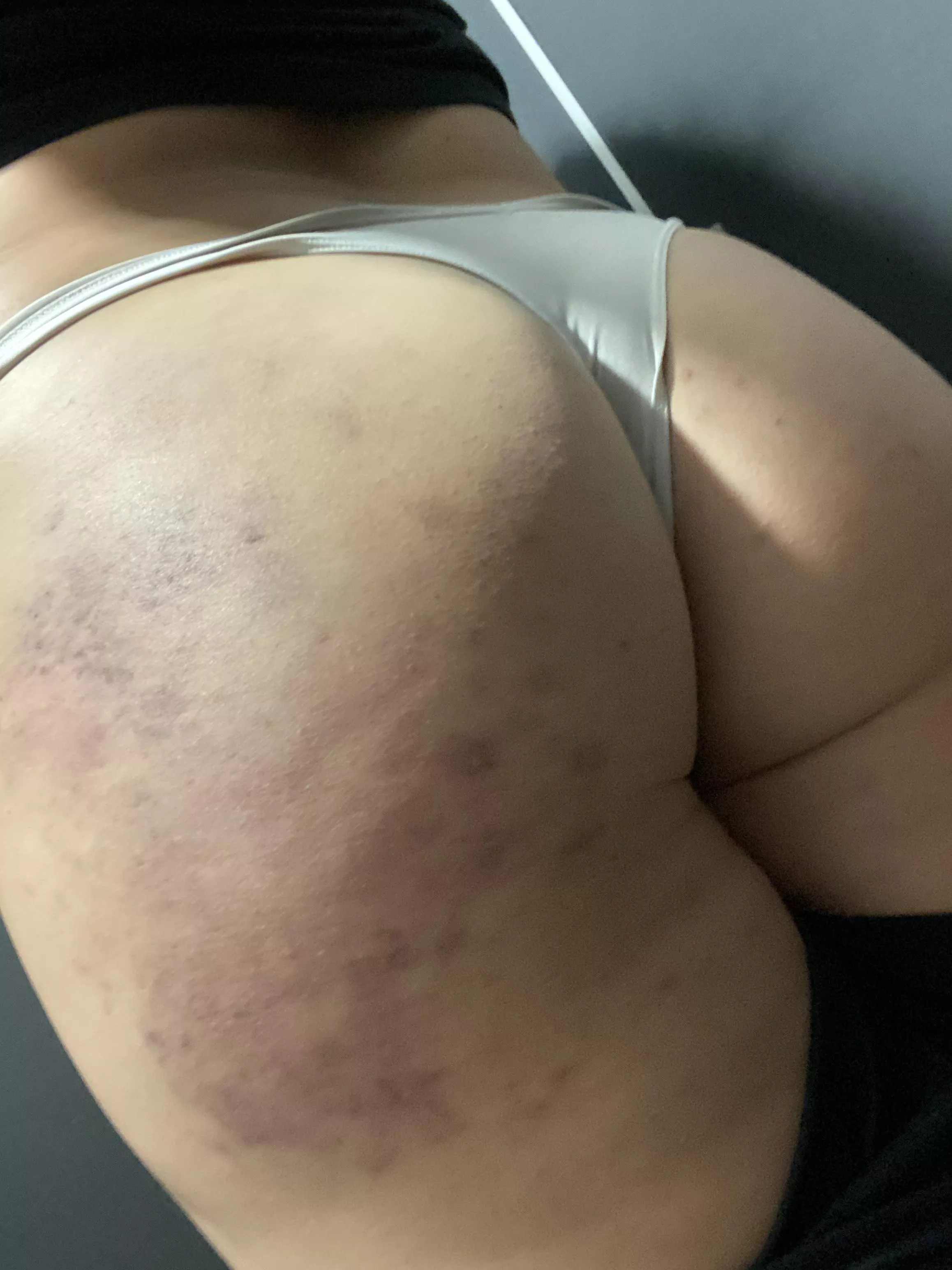 Hours after being spanked by two guys