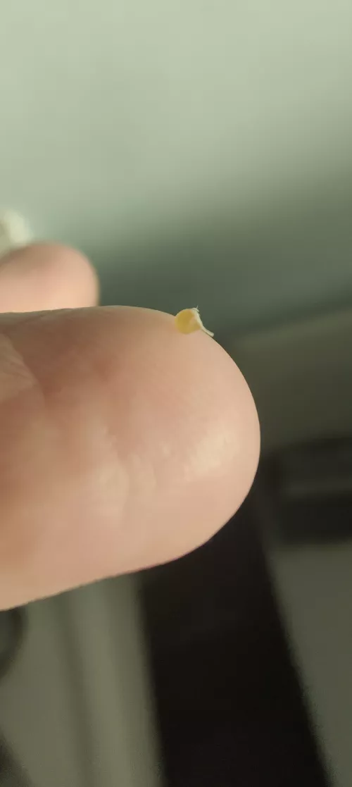 I just pulled some sort of christmas bauble out of my nose? It's been there for a while and I finally got annoyed enough to pull it.