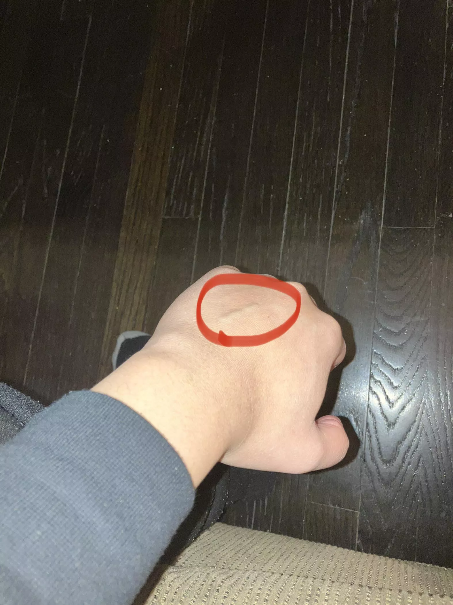 New vein? I play basketball, could it be a scratch mark? Only visible when veins pop.