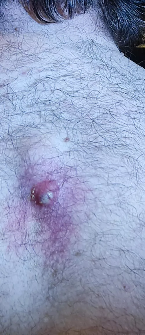 Demonic 3rd Eye on my back