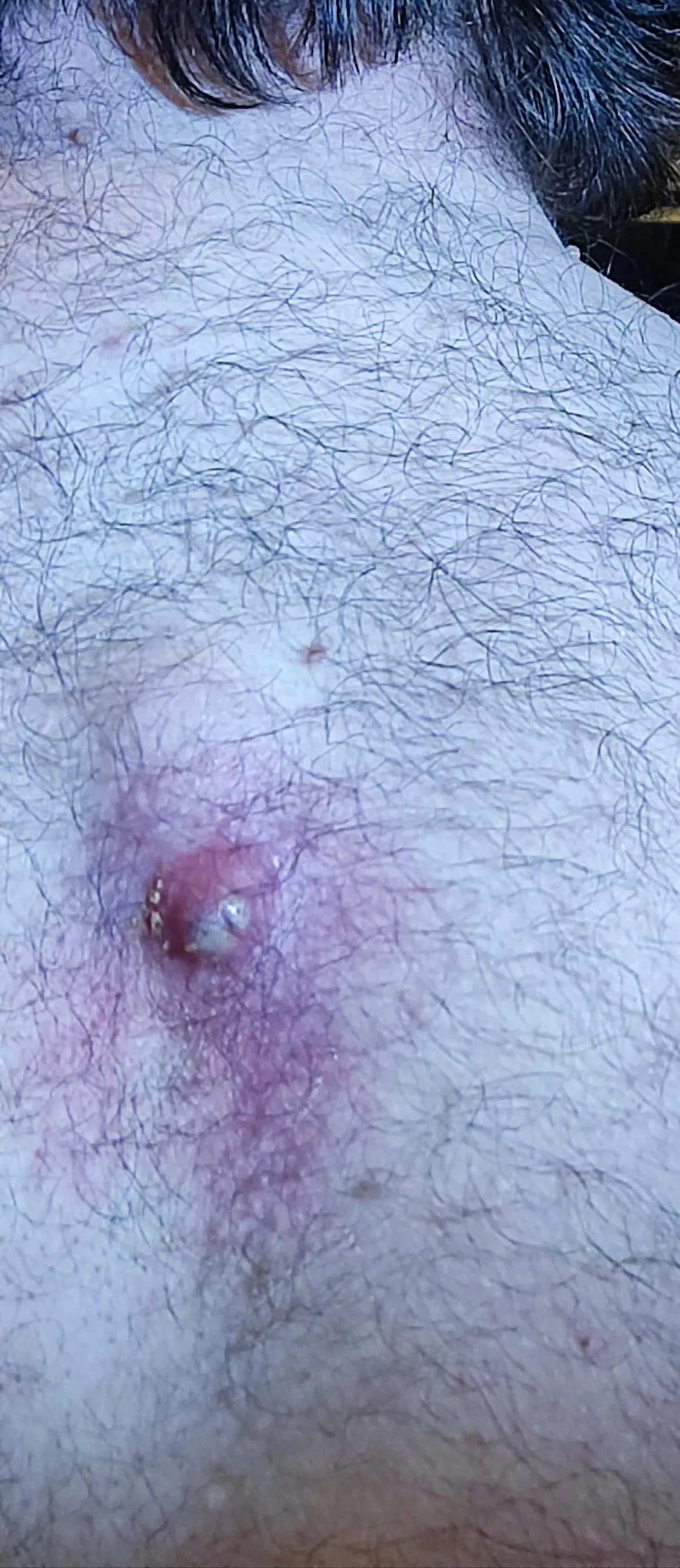 Demonic 3rd Eye on my back