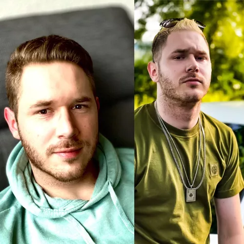 Alright guys but natural or blonde? 🐝