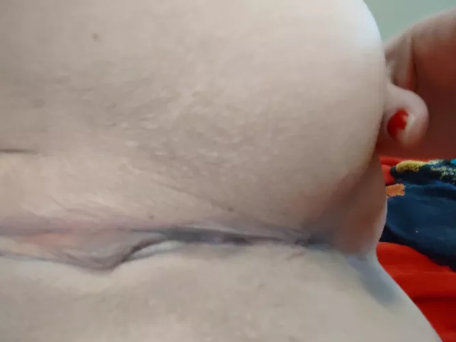 (F) Two freshly shaved holes for your viewing pleasure.