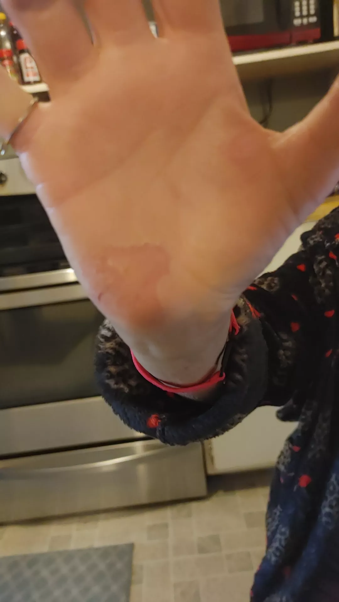 is this zombie hand forming??!