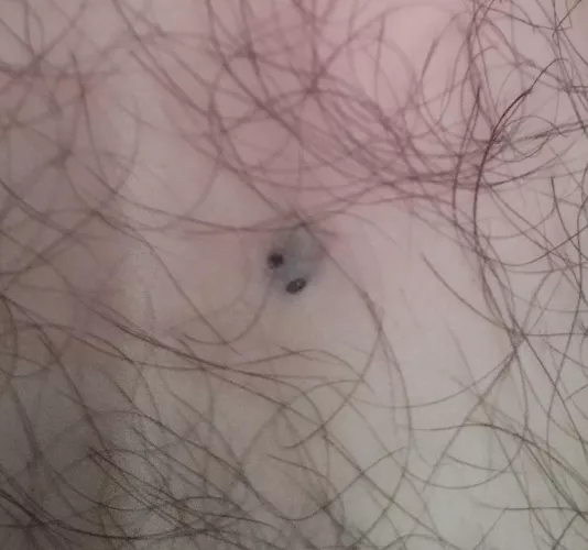 Little black spots under my thigh. Anyone know what is this?