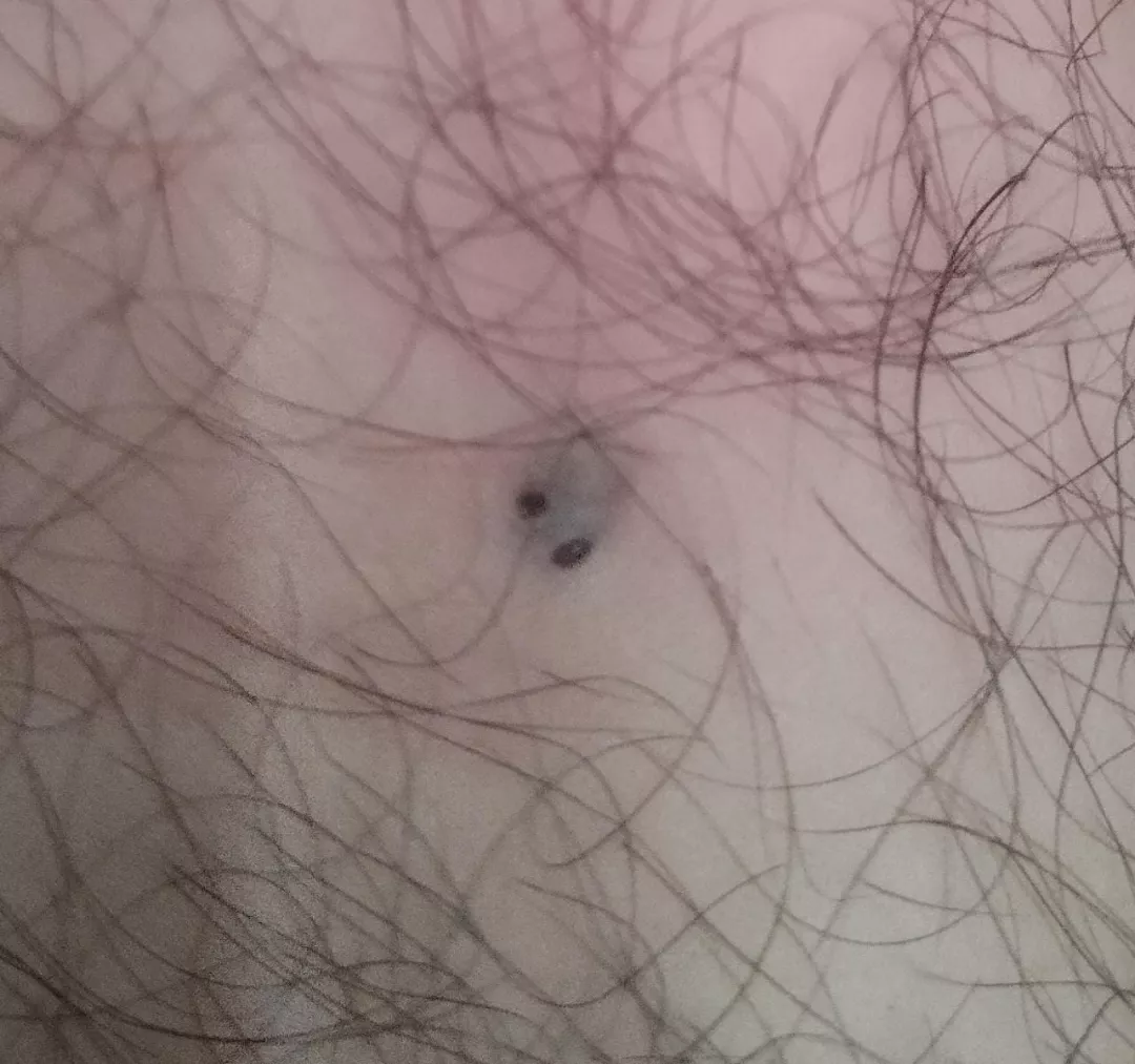 Little black spots under my thigh. Anyone know what is this?