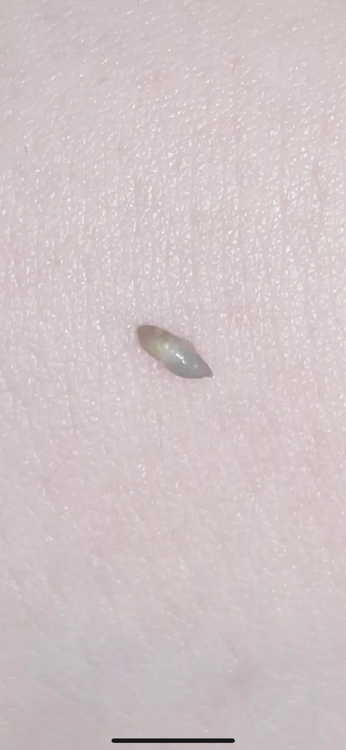 this just came out of my back