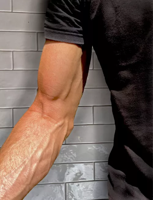 Half of a pair of cuddling arms [M47]