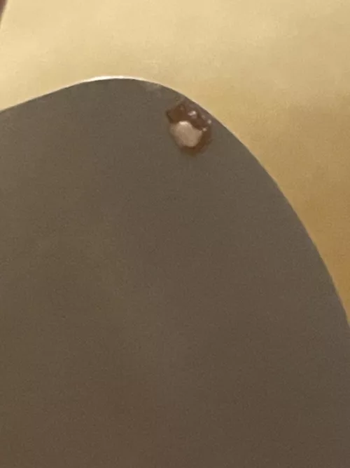 guess i had a pimple in my nose…