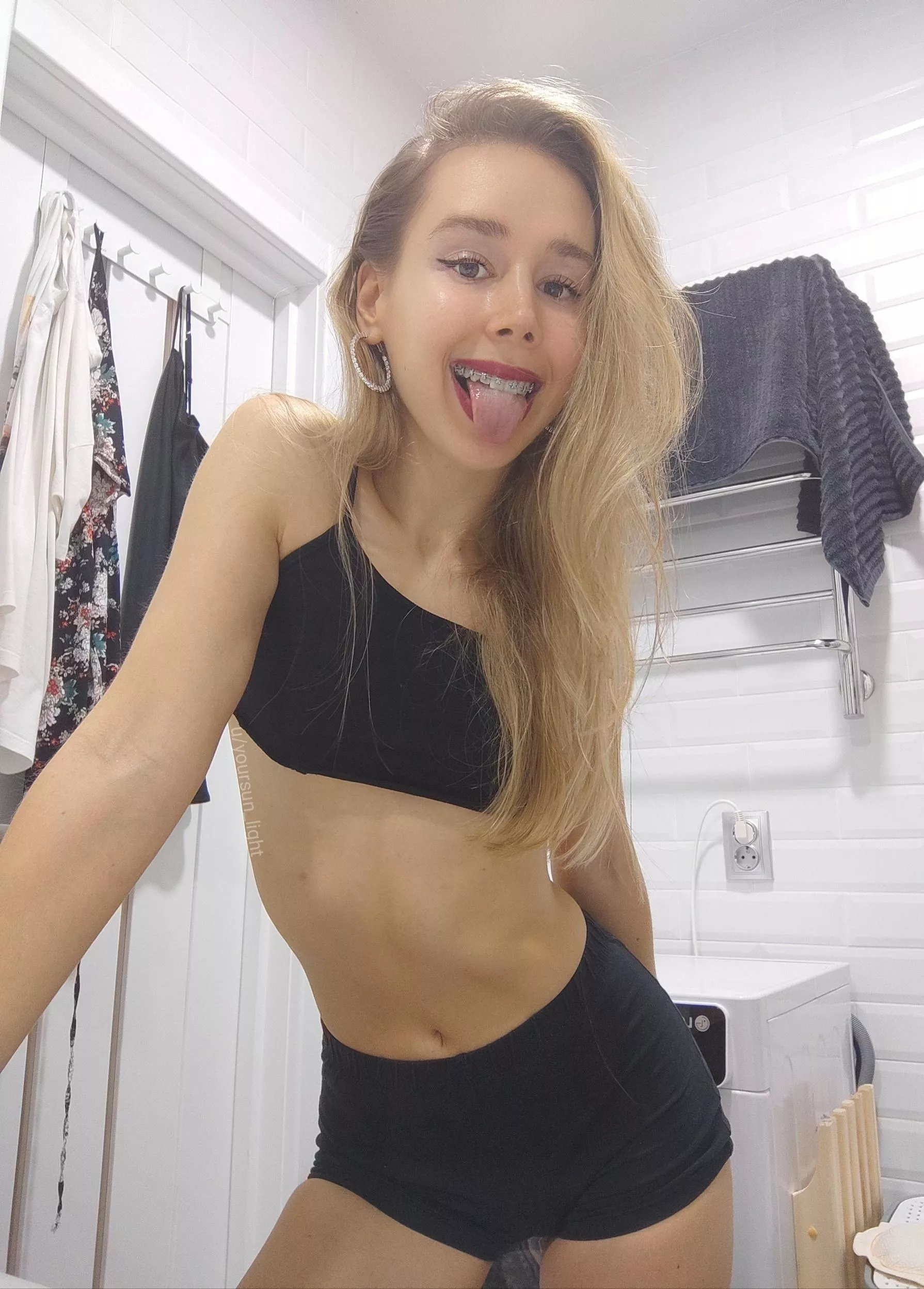 Red lips and braces 😘