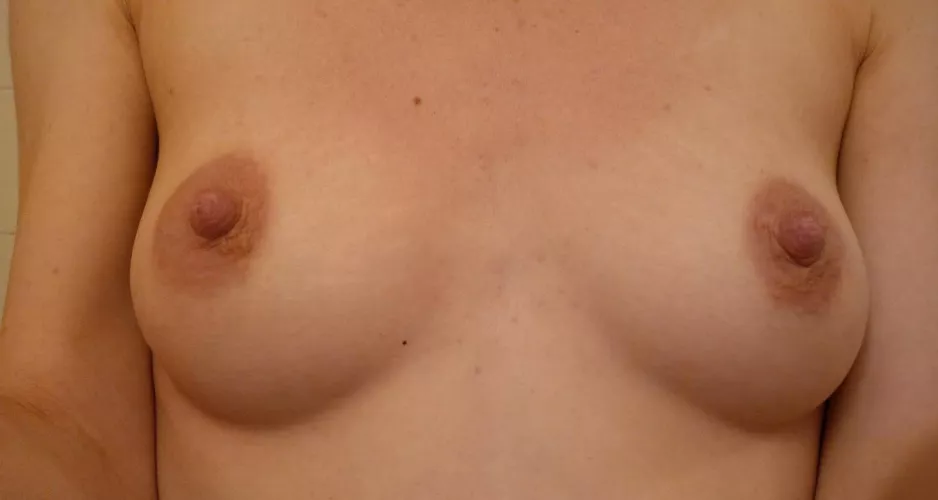 Detailed photo of my boobs😛your opinion?